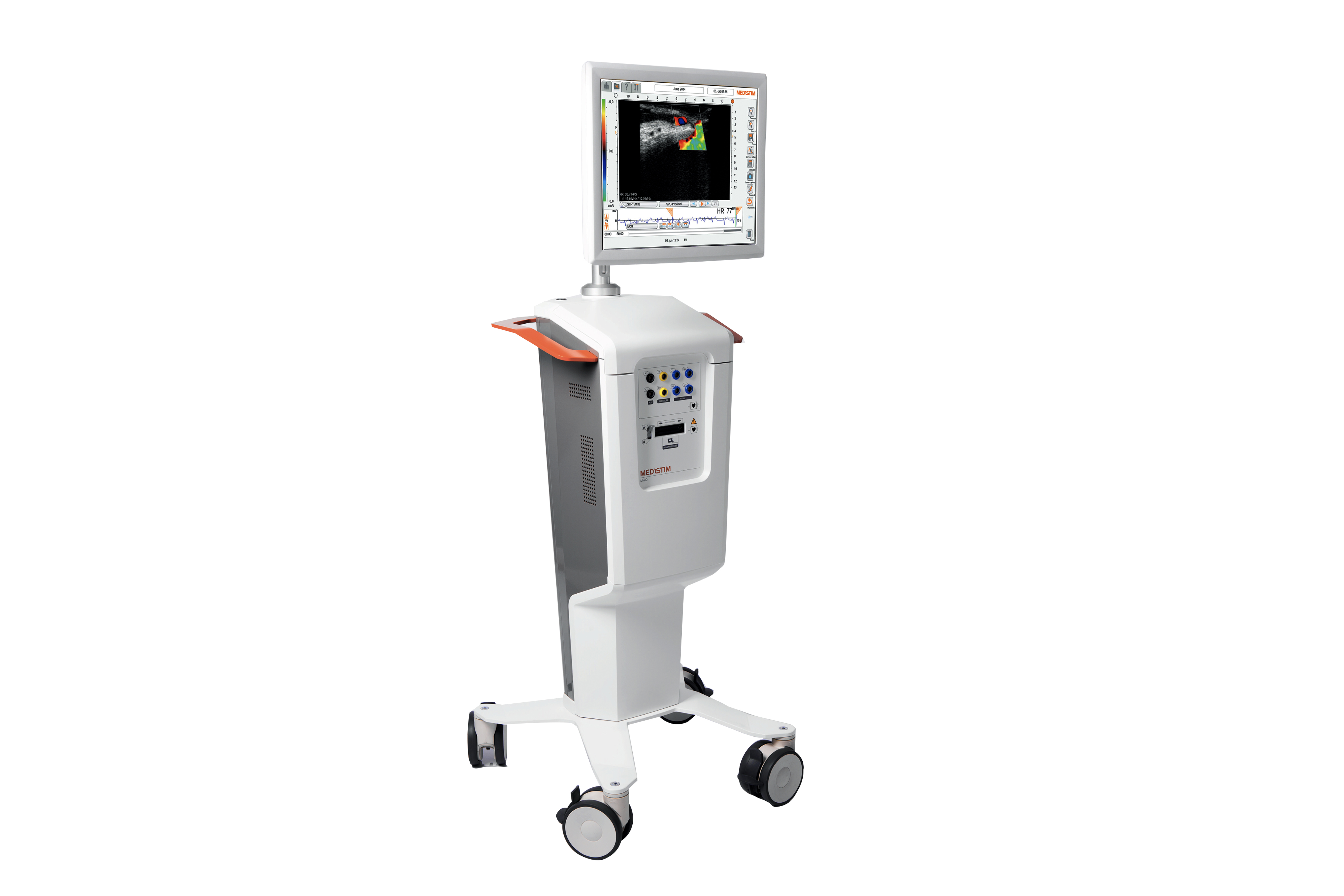 MiraQ TTFM System